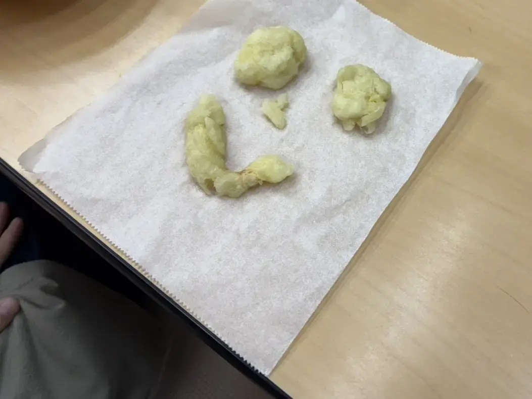 じゃがいも　笑顔